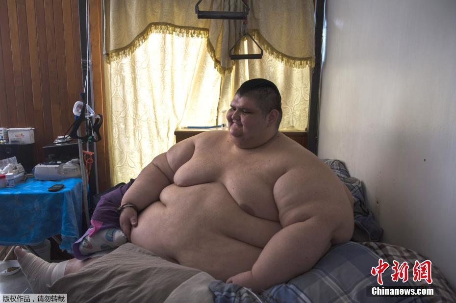 墨西哥男子体重曾达半吨 网友：有点像米其林(图)